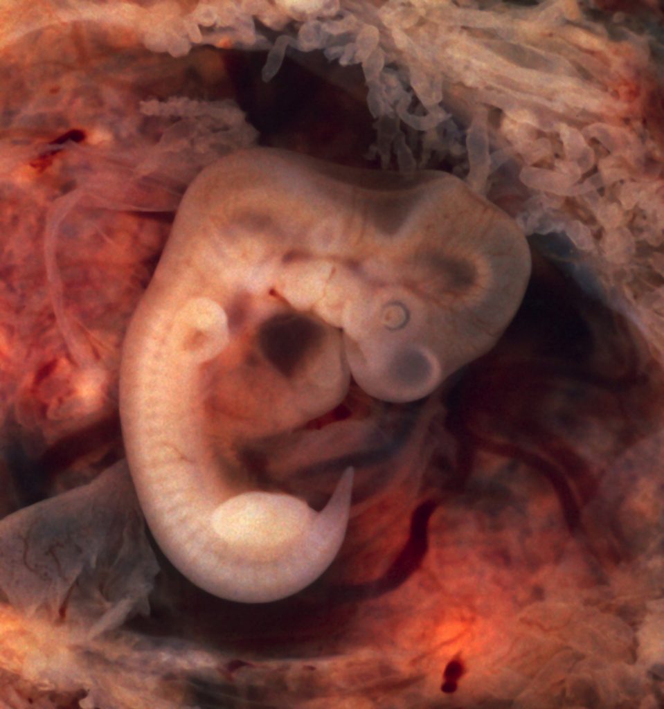 Human embryo showing tail