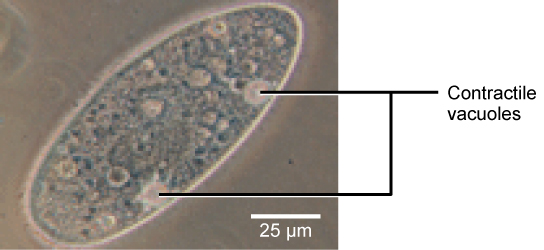 Paramecium with contractile vacuole