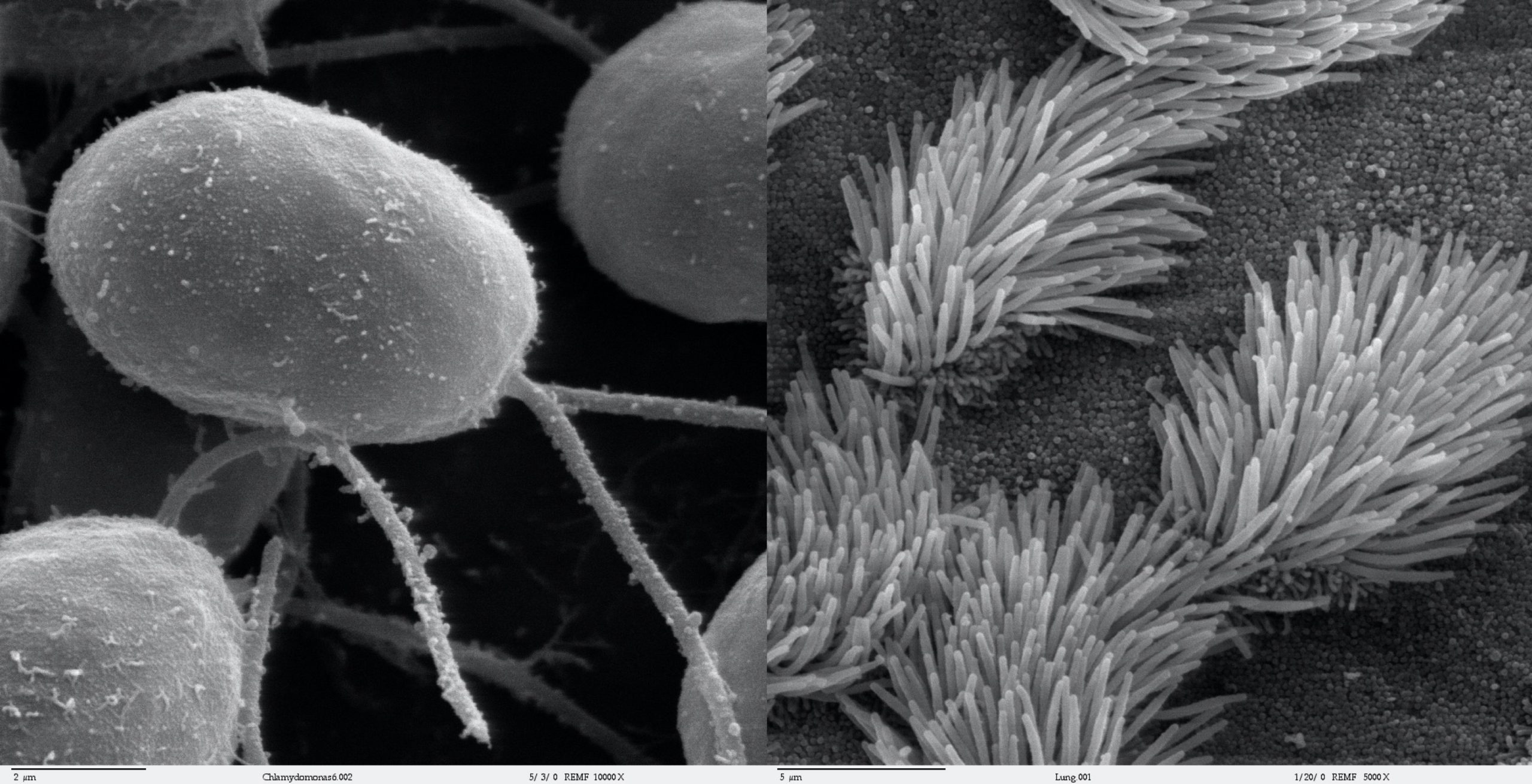 Electron micrographs showing two long flagella on a green algal cell on the left, and groups of short cilia in lung epithelial cells on the right.