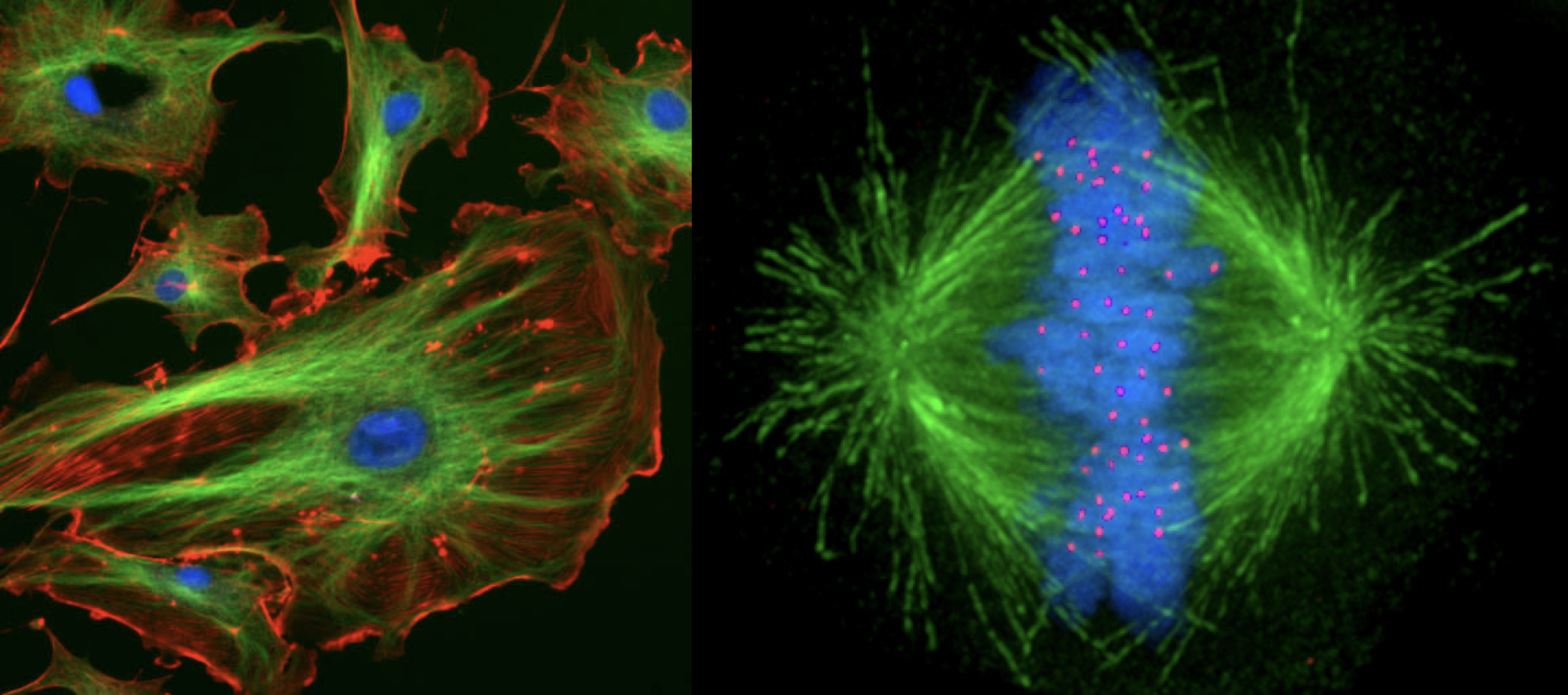 Photomicrographs showing microtubules during normal metabolism and during metaphase of mitosis.