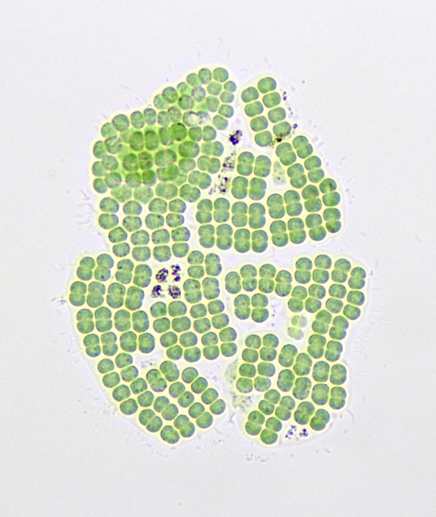 A light microscope photograph of a group of many round green cells attached in a sheet.